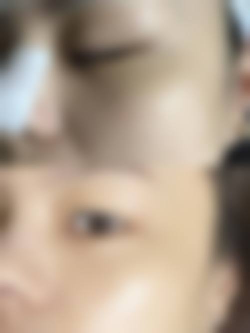 朱艳琼皮肤美容实例