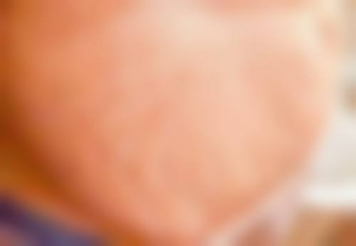 董玉洁皮肤美容实例