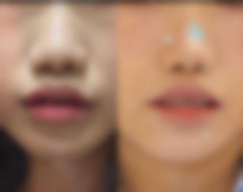 朱艳琼皮肤美容水平怎么样可靠吗?