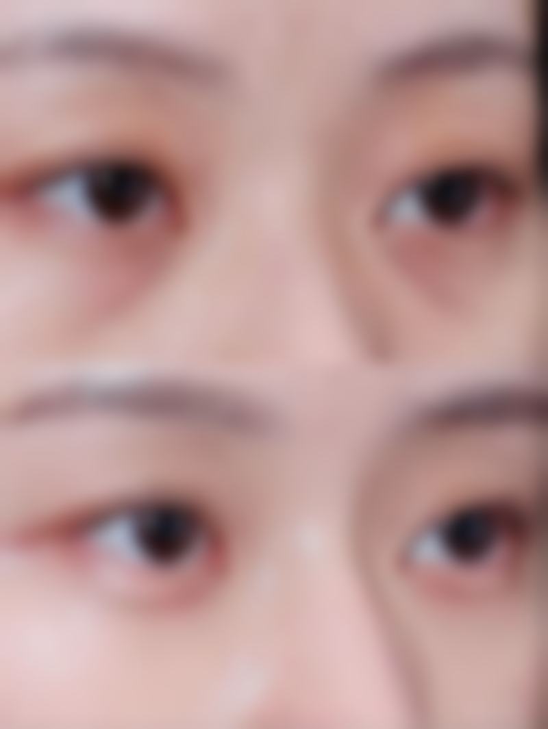 四、北京蜜邦整形美容医院实例