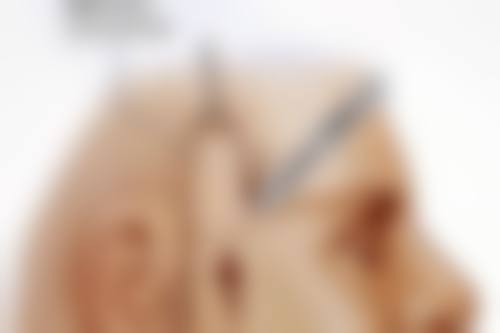 五、兰州姜医生整形医院实例