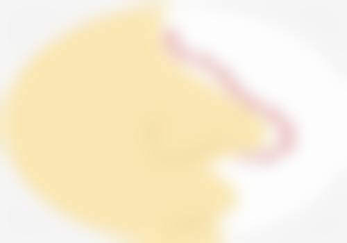 五、临沂孙松强整形医院怎么预约：