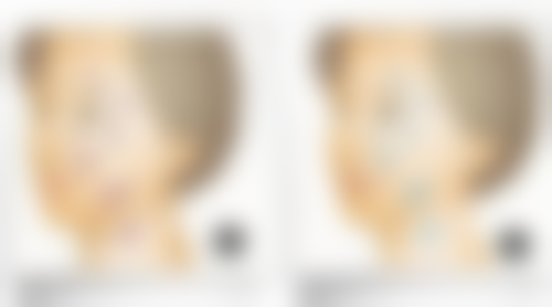 疤痕修复期究竟多久？个人体质和护理措施也重要