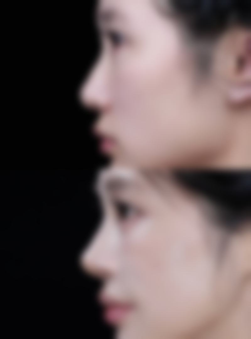 五、北京发之初雍禾植发医院怎么预约：