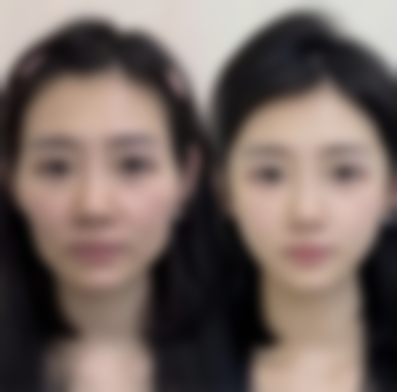 七、北京发之初雍禾植发医院真实的顾客评价如下：