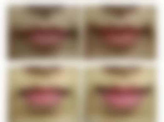 轻松告别下眼袋！多维度方案定制，结合医美术与日常护理重塑眼部年轻态 