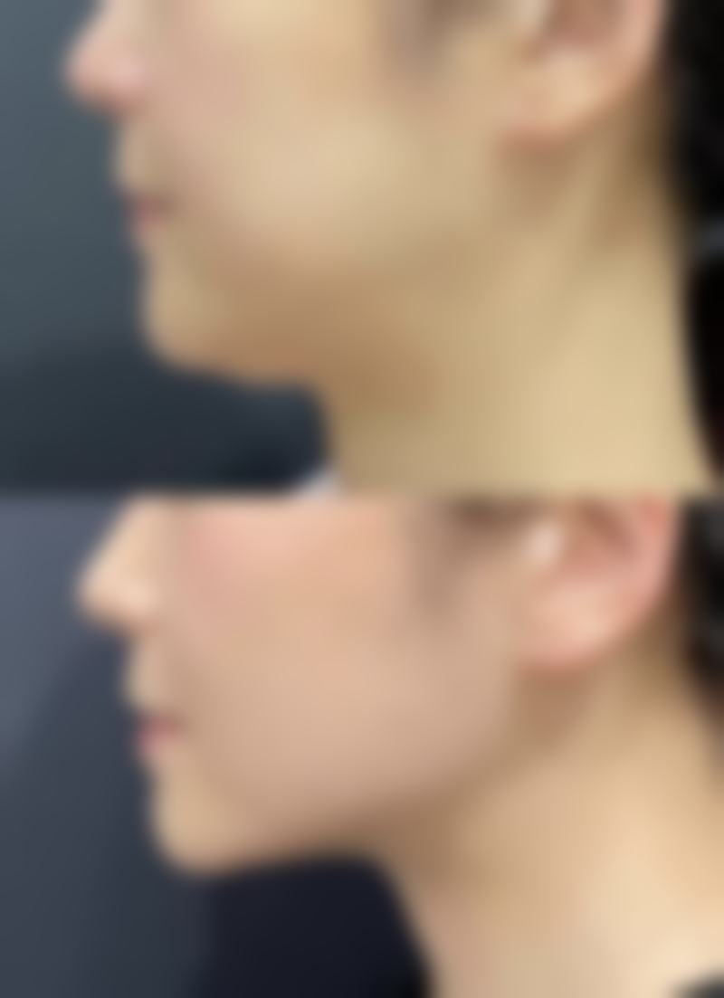 六、首都医 科 大学宣武整容医院整形科怎么预约：