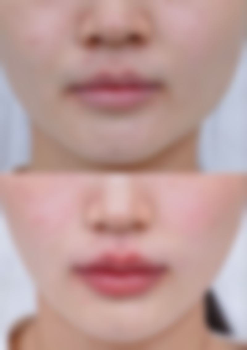 五、重庆好美整形医疗美容医院怎么预约：