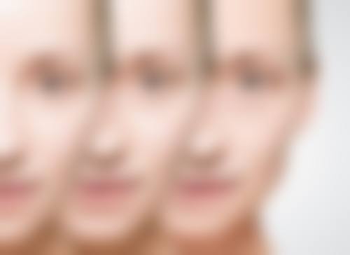 不同体质对切除眼袋疤痕修复的影响