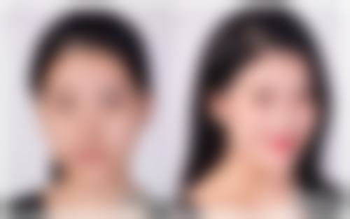 五、上海百汇医院整形美容科怎么预约：