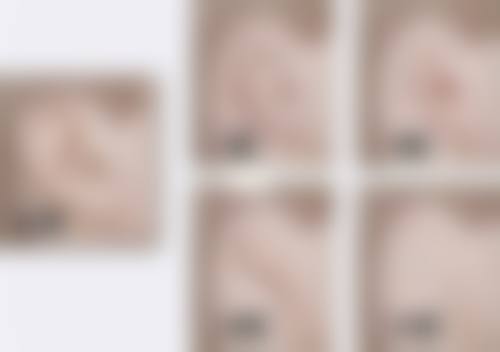 哪种双眼皮更适合你？选择合适双眼皮手术医院的要点