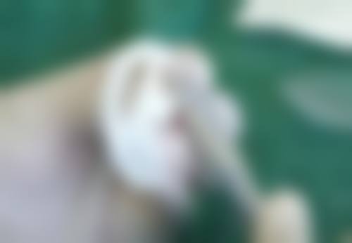 脸上疤痕疙瘩怎么治？选择靠谱医院是关键