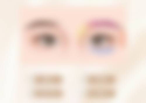 切除眼袋疤痕修复的心态调整