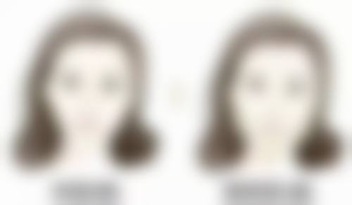 四、柳州美丽焦点美容门诊部实例