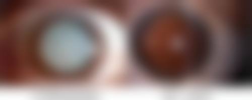 六、三门峡苏莱美医疗美容门诊部价格表:(仅供参考)