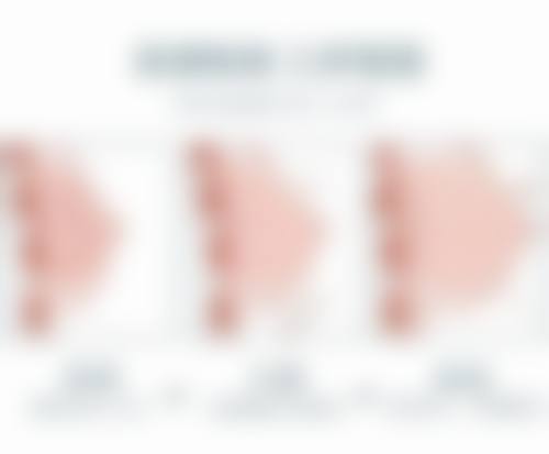 三、面部注射精细化雕刻项目详情