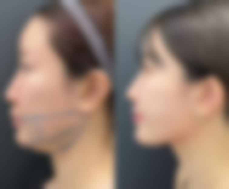 四、昆明美莱医疗美容医开展的主要项目和特色项目: