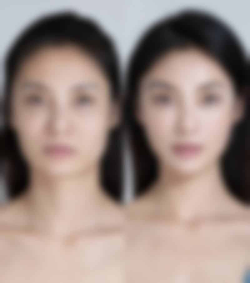 六、福建宁德东侨东韩医疗美容门诊部怎么预约：