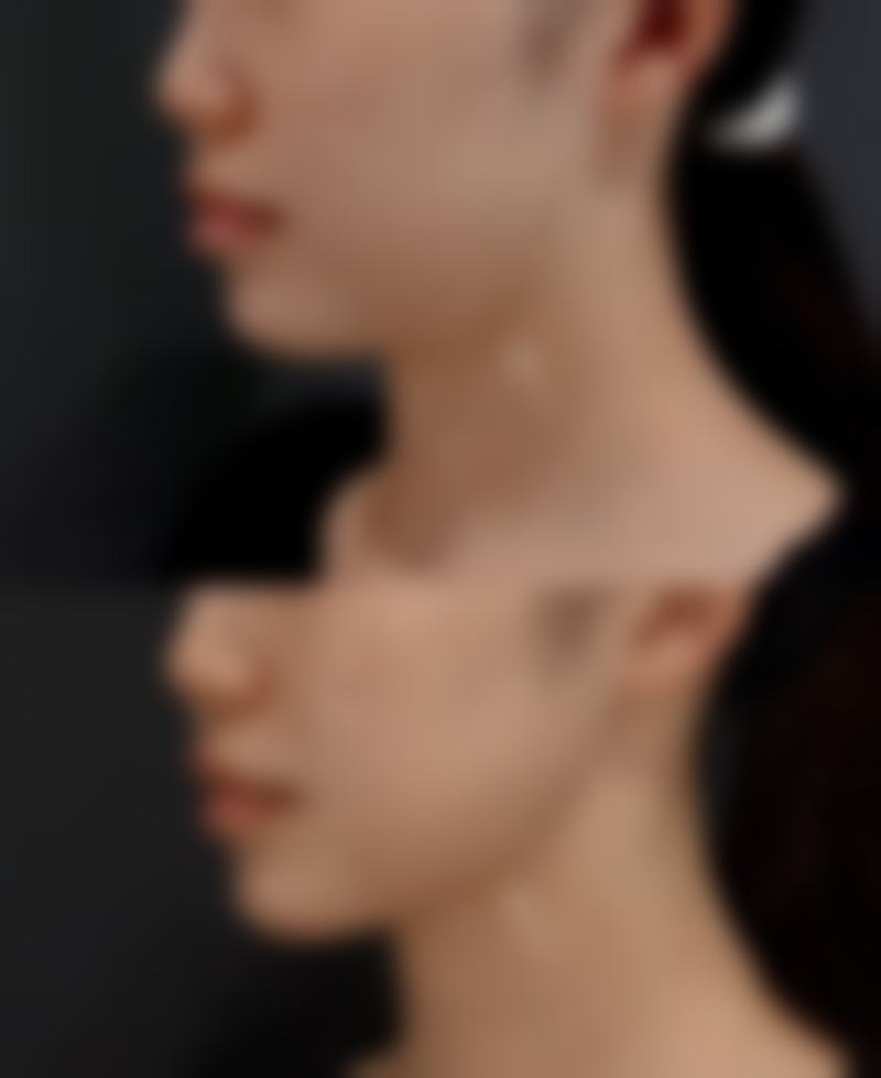 七、南昌碧莲盛植发医院价格表：（仅供参考）