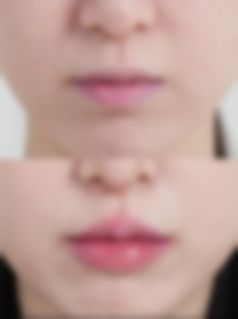 六、包头刘恕美容整形医院怎么预约：