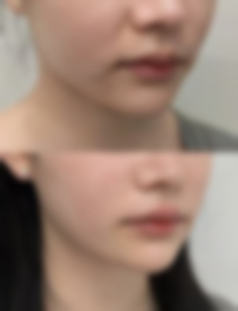 五、山东威海环翠区董立鹏医疗美容诊所怎么预约: