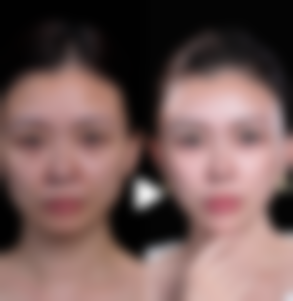 整形美容科:全方面改善眼部外观