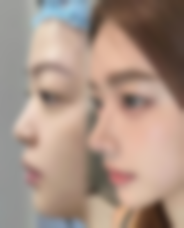 七、龙岩新罗区爱丽诺医疗美容价格表：（仅供参考）