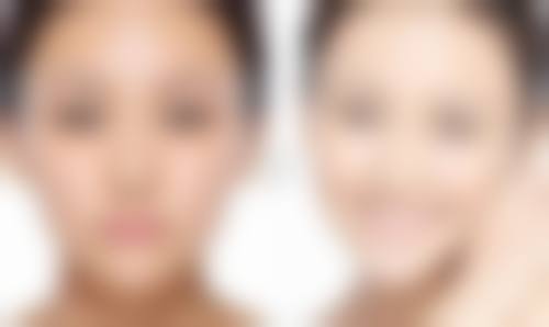 开扇型双眼皮宛如折扇展开，内窄外宽自然灵动，适配多类眼型凸显东方含蓄美 