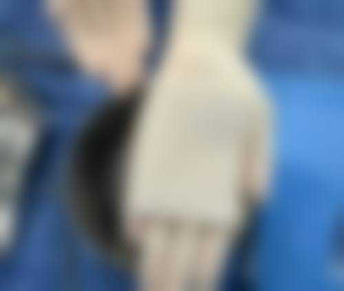 填充眼袋选啥填充物好?不同填充物适合不同人群