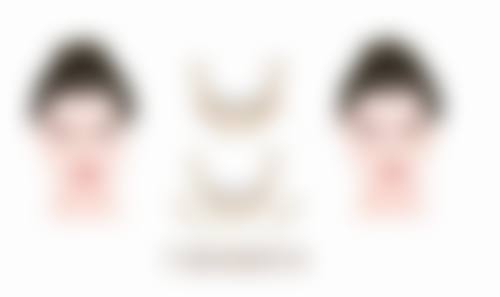 割双眼皮后能喝咖啡吗？不同恢复阶段饮用建议及医院专业护理攻略大揭秘 