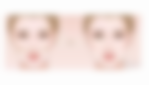 进口国产膨体大比拼：如何选择适合自己的膨体材料