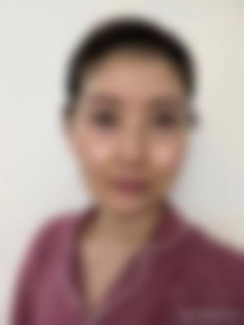 刘学锋面部微雕实例