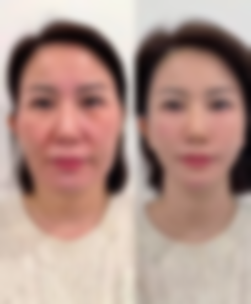 二、南平仁爱医院美容整形科正规吗？来看看医院资质