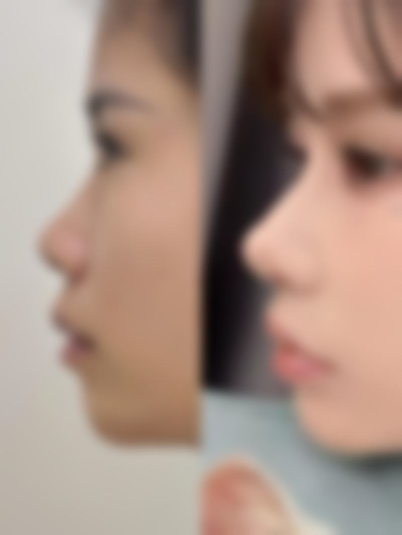 二、邯郸莱媚俪整形医院正规吗?来看看医院资质: