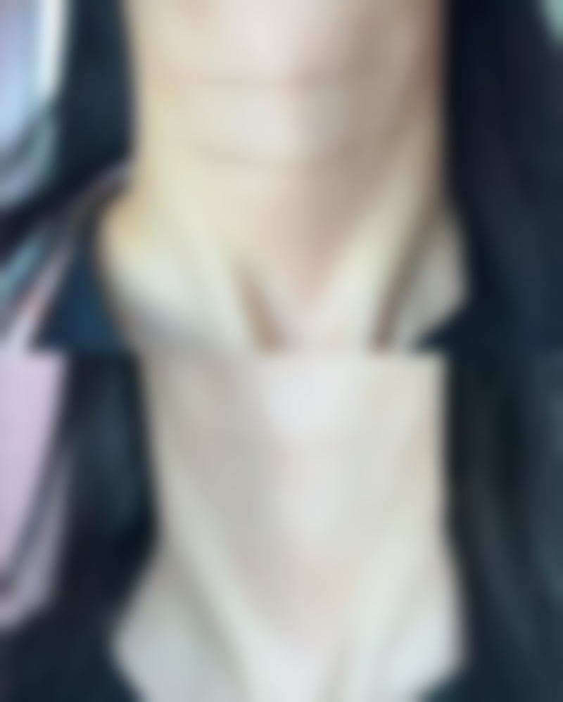 疤痕疙瘩难以自行消退？正规医院多方案治疗，助你改善外观重拾自信 