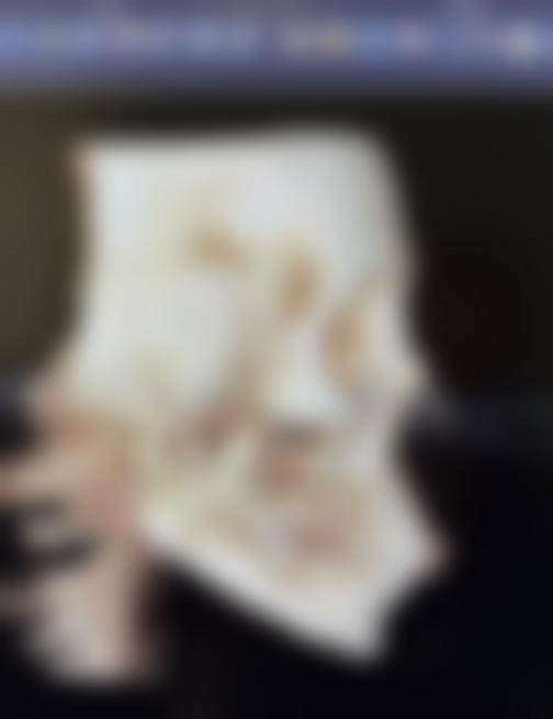 进口国产膨体大比拼：超体和卡麦拉的独特优势