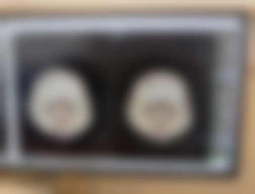 七、北京德美诊联凌云医疗美容诊所价格表：（仅供参考）