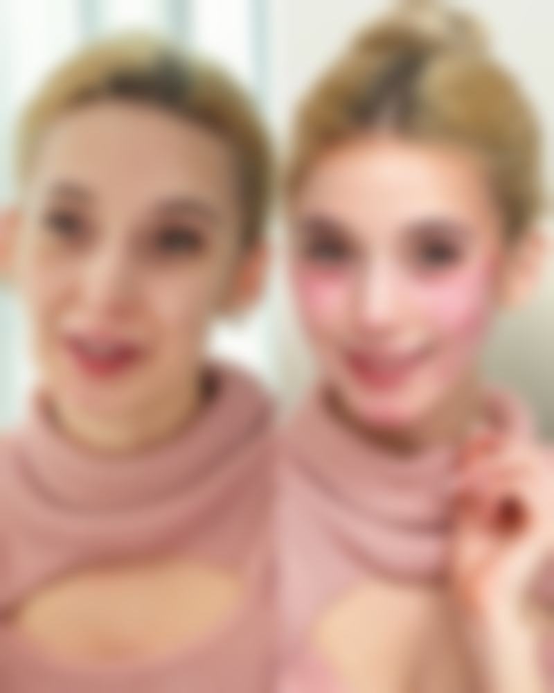 割双眼皮后能喝咖啡吗？不同修复阶段饮用建议全知道