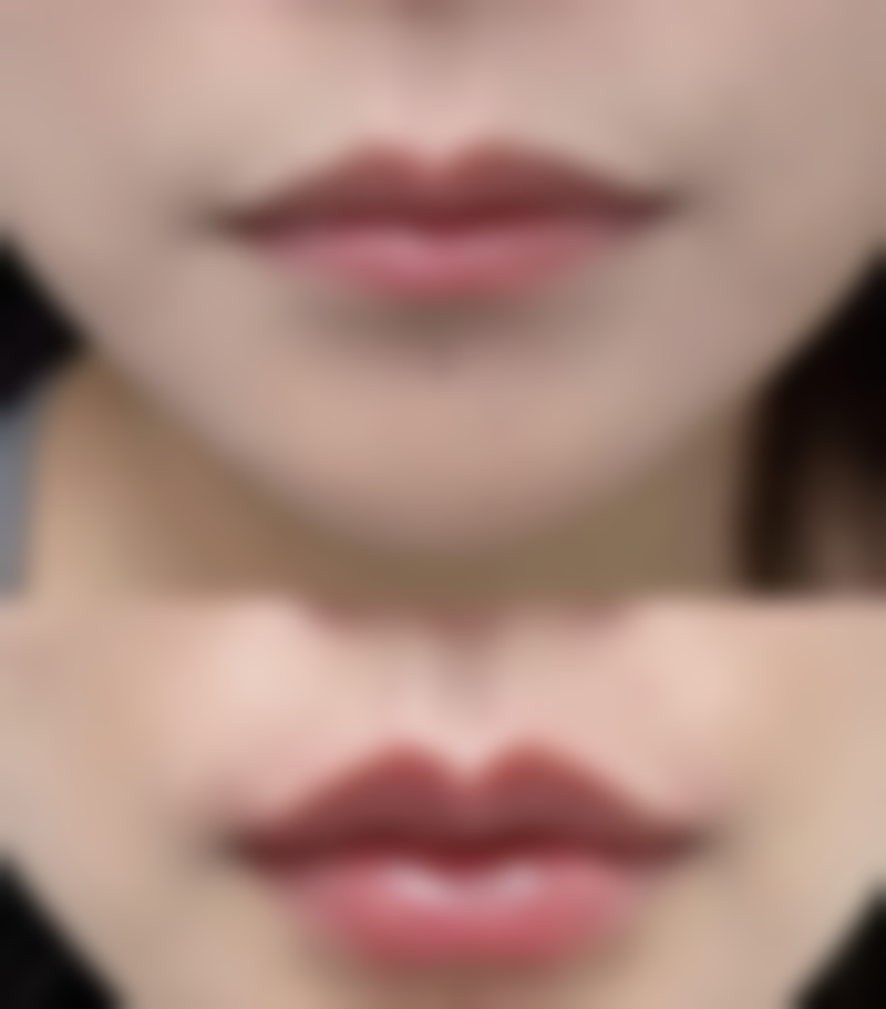 补充富含锌的食物，促进皮肤修复