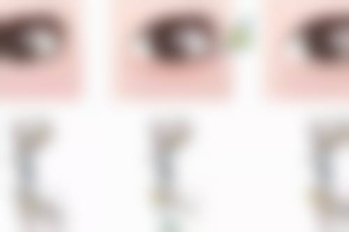 四、湖南国颜医疗美容实例