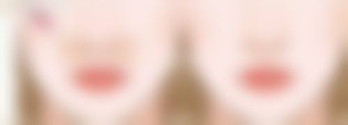 六、昆明BBH珠玑医疗美容门诊部价格表：（仅供参考）