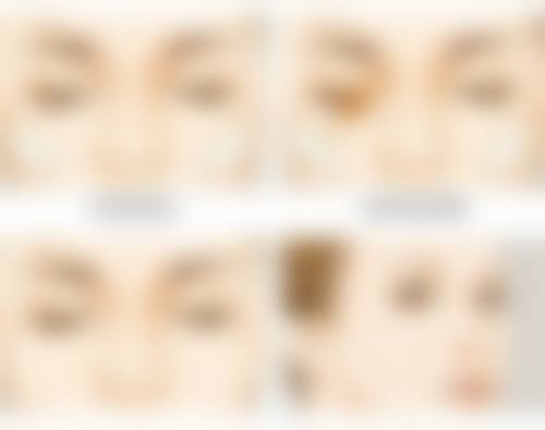 四、杭州悦美格医疗美容诊所实例