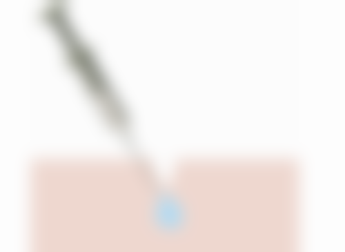 四、昆明莱森植发实例