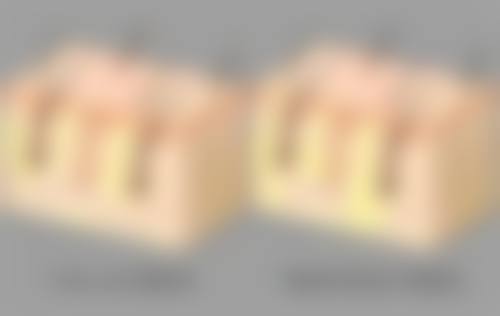 妙桃隆胸：修复快速重返生活