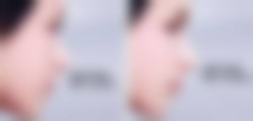 五、西宁辛医生整形医疗美容诊所怎么预约：