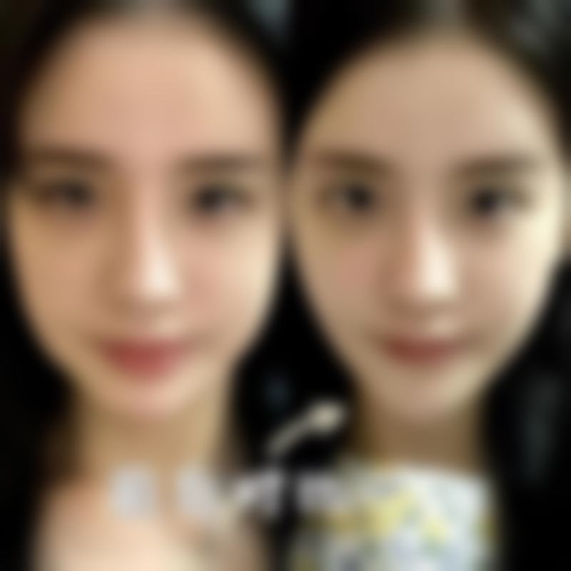 七、昆明BBH珠玑医疗美容门诊部真实的顾客评价如下：