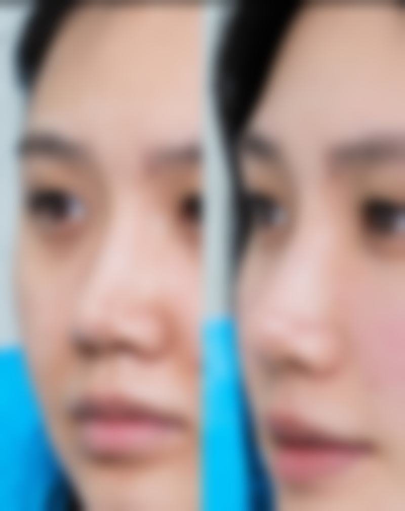 五、昆明BBH珠玑医疗美容门诊部怎么预约：