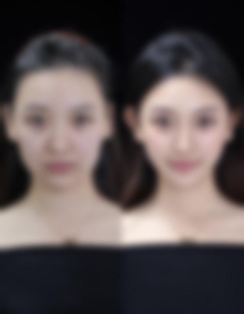 六、湖南国颜医疗美容价格表：（仅供参考）