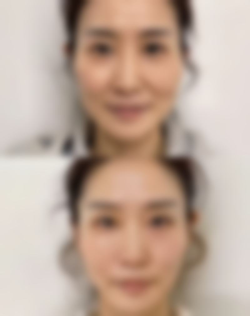 姜春仁面部整形水平怎么样可靠吗？