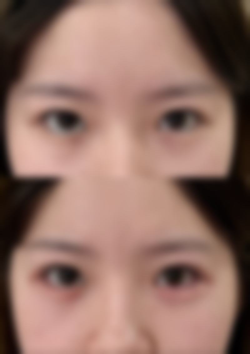 八、广东药学院附属医院激光整形美容中 心真实的顾客评价如下：